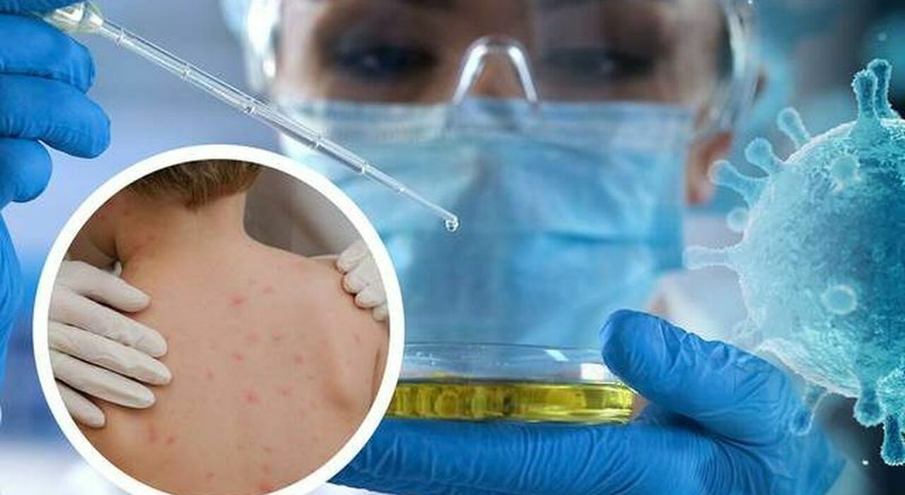 La situazione sanitaria: Covid e vaiolo delle scimmie.