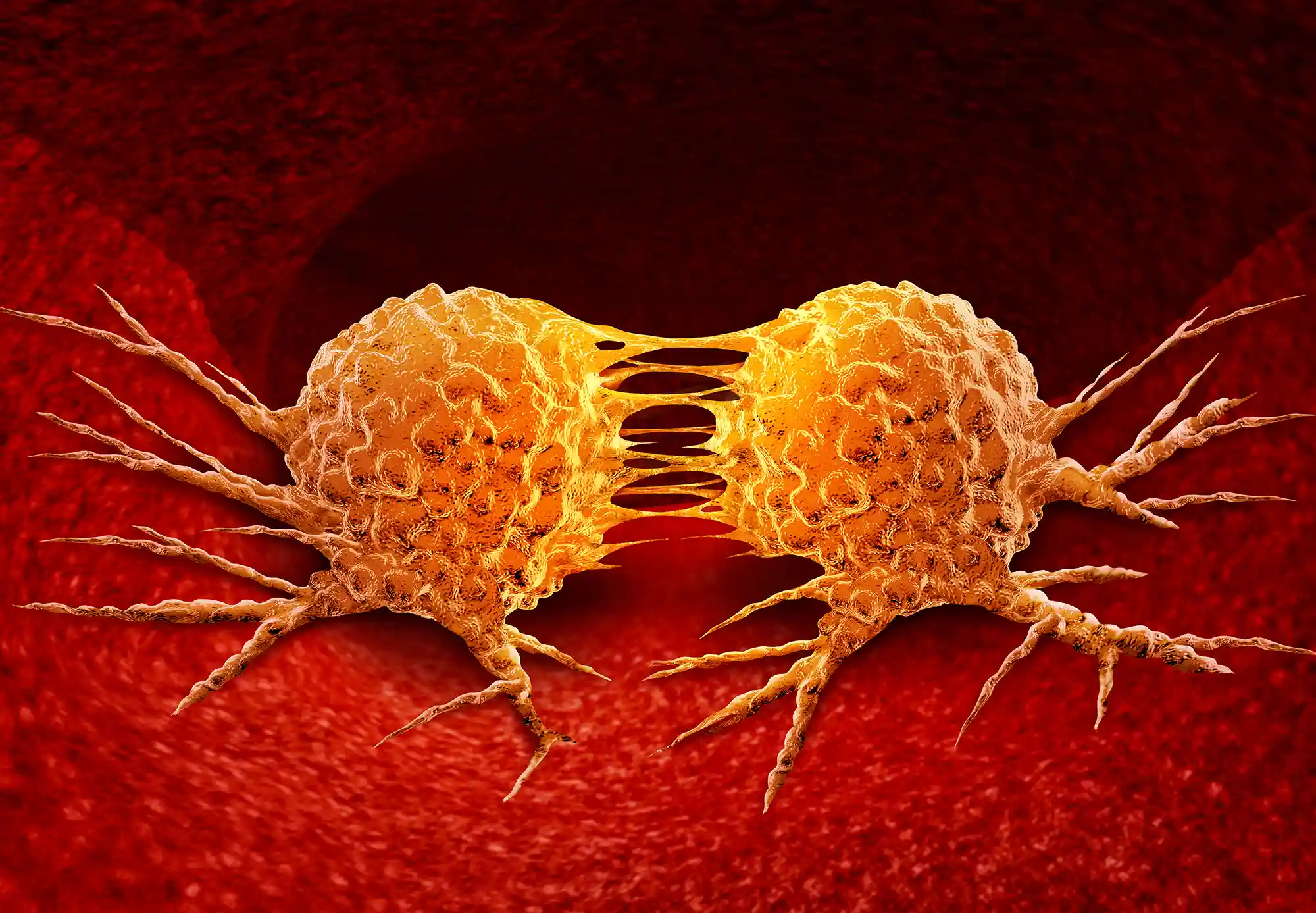 Tumori. Cala la mortalità. Sale  quella per colon retto fra i 25 e i 49 anni 