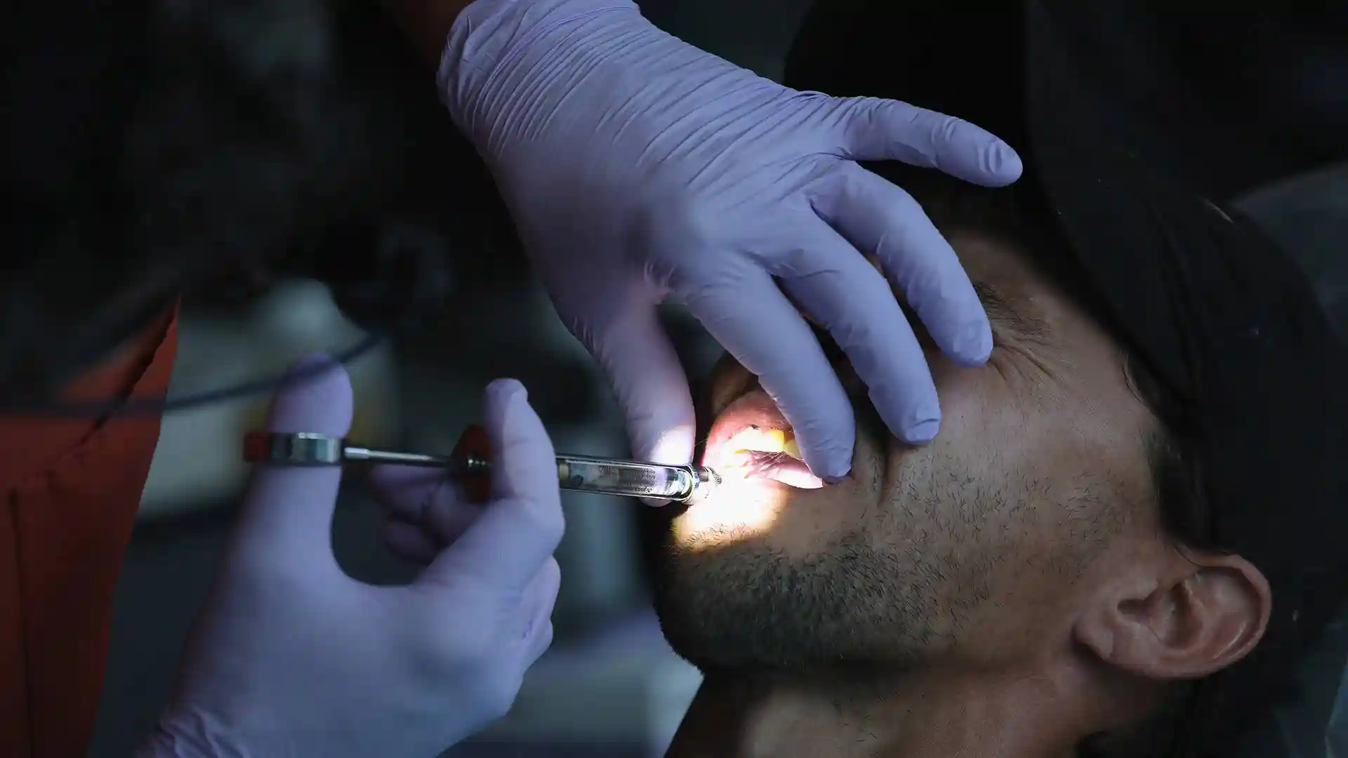 Overtreatment, un inglesismo necessario. Come ti spennano nei centri odontoiatrici speculativi