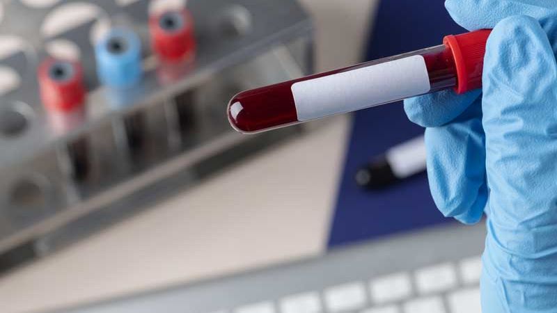 I donatori di sangue veneti vogliono partecipare alla programmazione
