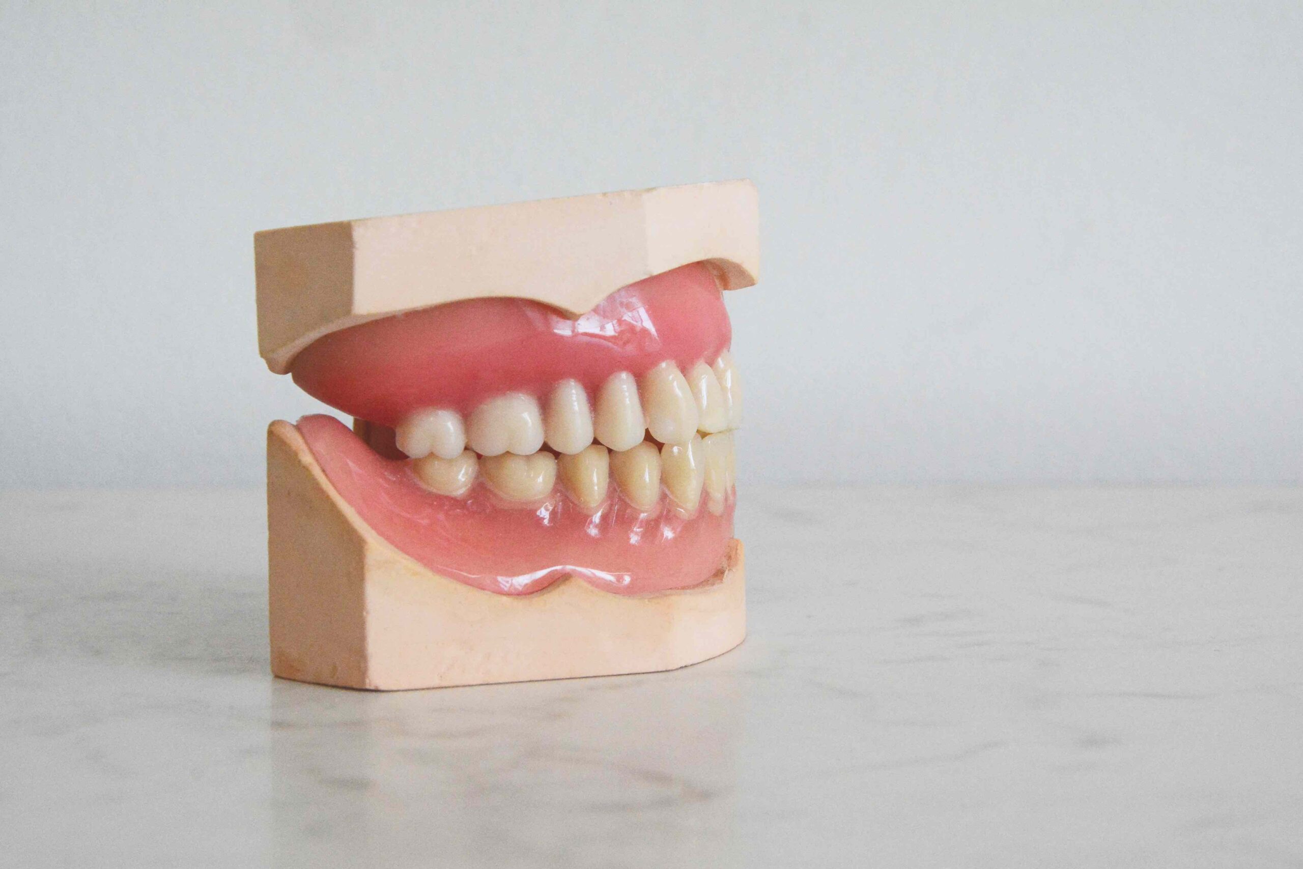 Il Consiglio Superiore di Sanità vorrebbe estendere le cure dentistiche a carico del Ssn
