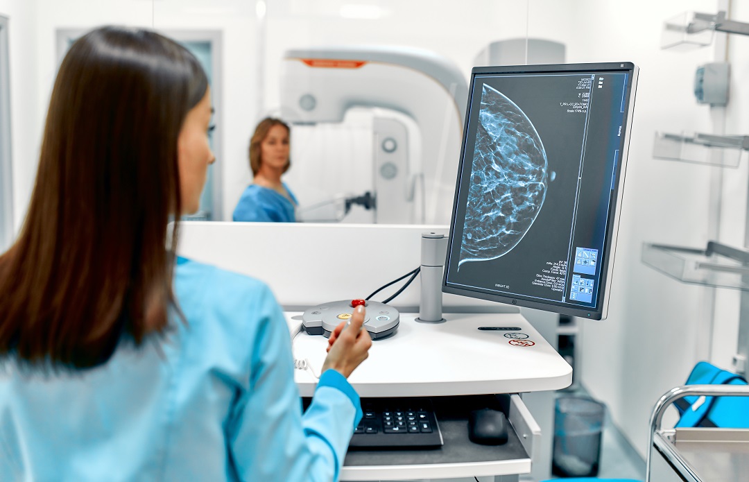 L’incidenza di 17 tumori aumenta di generazione in generazione