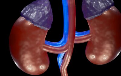 L’insufficienza renale nella cirrosi epatica
