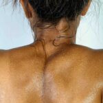 Estate, vacanze, sole ma attenzione al melanoma