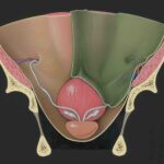 Cancro della prostata. 40 mila casi solo nel 2024