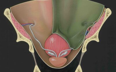 Cancro della prostata. Colpisce quasi il 10% dei maschi