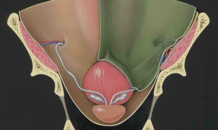 Cancro della prostata. 40 mila casi solo nel 2024