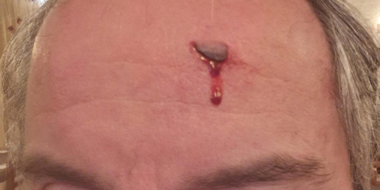 Rissa e ristoratore ferito in pieno centro