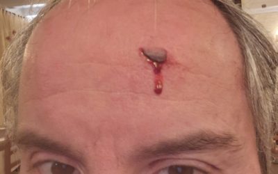 Rissa e ristoratore ferito in pieno centro