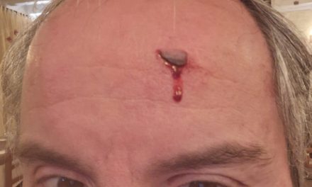 Rissa e ristoratore ferito in pieno centro