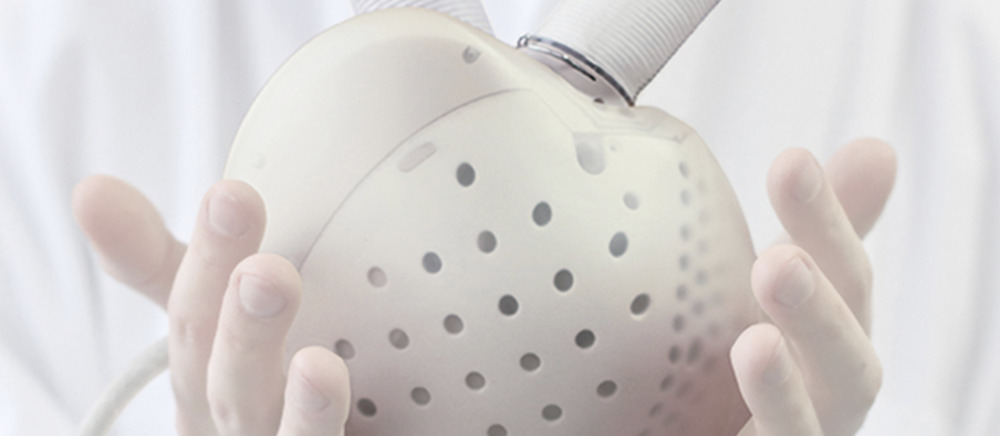 Trapiantato paziente veronese 50enne con il primo cuore artificiale del Veneto 2 carmat