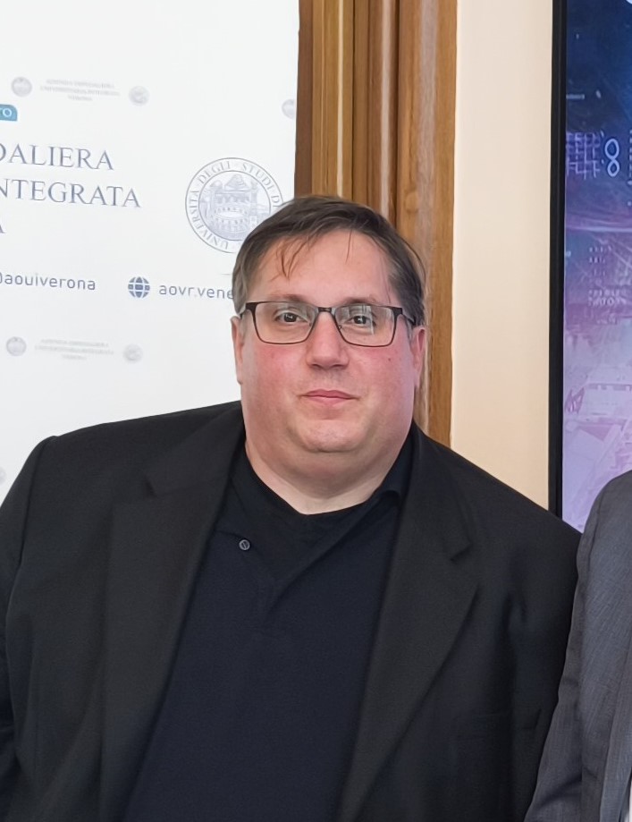 Sclerosi Multipla: videogame e solette con sensori per curare e monitorare i pazienti a distanza 2 prof calabrese