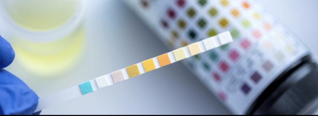 Prevenzione, il momento giusto è prima 1 Prevenzione, il momento giusto è prima