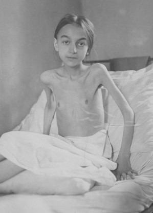 La carestia del 1919 spiega l’ascesa del nazismo 1 TubGirl1920 1